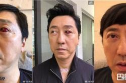 庾澄庆的眼睛怎么了？会不会出现视力问题