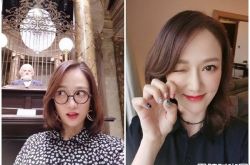 陈乔恩秃头怎么回事？爆超高发际线掉发近照