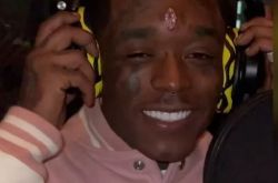 Lil Uzi Vert额头镶钻石 4个月后伤口感染摘除