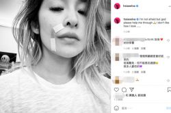 萧亚轩揭开被狗咬伤疤 复原等5个月陷人生低潮