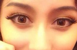 白澍个人资料,白澍整容