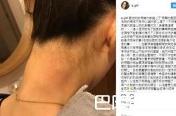 阿娇被指言行反常精神异样 访谈举止诡异事后发文谈原因