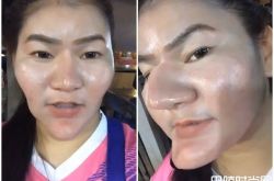 泰女整容成巫婆脸 整容失败只能转移职业了