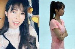 茵茵为了男友整容 整牙是真的