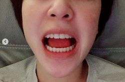 黄小柔素颜真面目曝光 这是整容了吗