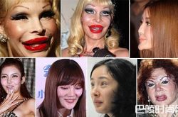 网红整容都是些什么鬼？整到你怀疑人生