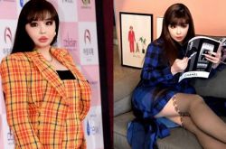 朴春脸部变迁史 脸肿3倍大是有病吗