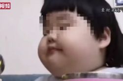 3岁网红佩琪爸妈被骂 为了钱胖到35KG