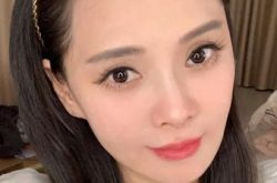 伊能静额头冒白点 疑是整形后遗症