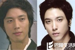 郑容和整容前后照片,郑容和个人资料