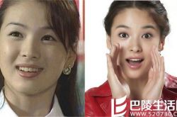 宋慧乔有没有整容,宋慧乔个人资料