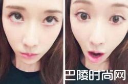 林志玲现身医院整容铁证 经纪人称只是打美白针