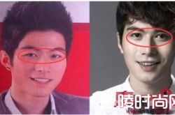 陈学冬整容前后照对比 和郭敬明什么关系同性恋内幕惊人