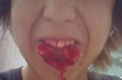 胆小勿进！沉珂自残割舌照片曝光 传沉珂家庭背景坎坷