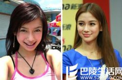 Angelababy整容了吗,angelababy整容鉴定