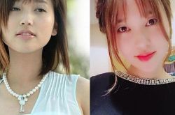 金莎自曝整容 金莎手术