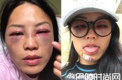 女星录节目被暴打成猪头 蔡嘉燕上节目被暴打