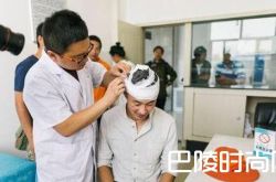 综艺真人秀节目中受伤的明星盘点