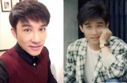 江明学自摔毁容缝百针 爆明星整形名单蔡依林小S是同一家