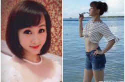 兵家绮是谁？腰痛1个月椎间盘切除手术