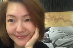 小S徐熙娣为求完美身材 自爆打肉毒玻尿酸美容