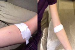 梁洛施患肺炎高烧 吊点滴露皮包骨手臂惊呆