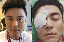 刘至翰青光眼陷失明危机 刘至翰微博资料照片