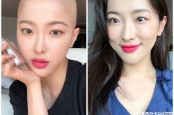 网红Sae Byeock患癌症剃光头发 男友不离不弃助抗癌
