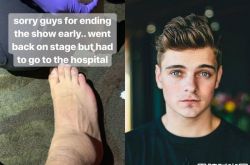 Martin Garrix摔下DJ台送医急救 脚踝摔伤可能影响表演