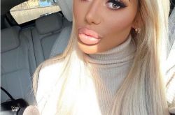 24岁英国女星克洛伊砸百万整容 超肿嘴唇像挂两根香肠