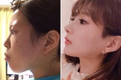 高嶋明实整容下海 黑历史被深扒