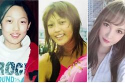 吴晓辰从14岁开始整容 16年整形100次