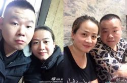 岳云鹏老婆郑敏什么病 头发全剃需做手术