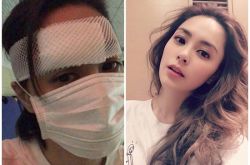 阿娇酒店头破6cm大洞缝数十针 经纪人曝惊悚伤照