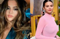 赛琳娜换肾被酸 大腿疤偷遮3年首曝光