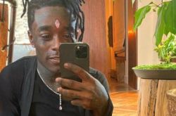 lil uzi vert镶钻被感染 装逼要后悔了