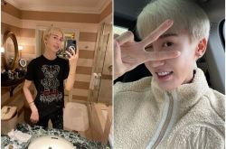 蛇精男刘梓晨无P图正常模样曝光 确诊新冠后重生