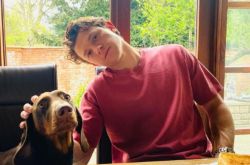 英国秃头基因太强 男神汤姆赫兰德也遭殃