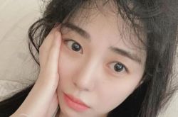 AOA珉阿在家轻生 过度出血术后无意识