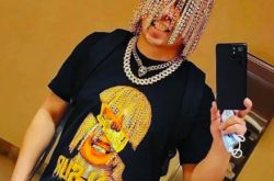 Dan Sur金链子植入头皮怎么回事 