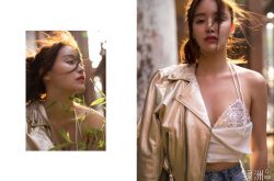 高溜整容失败鼻子坏死 时隔1年惊人近照曝光