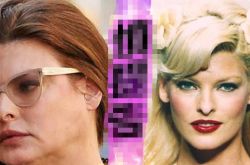 90年代绝美超模泪诉整形失败 爆永久毁容内幕