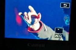 张杰演唱会高空坠落摔伤 紧急送医伤势曝光