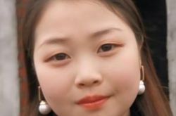 胖刀刀刀妹要快乐什么病病危了 脸长红斑块插鼻管泪崩