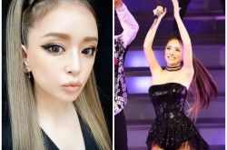 日本天后滨崎步惊传过敏性休克 演唱会紧急取消3天前才骨折