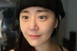 文瑾莹曝伤疤照 伤口横跨小臂熬了4次手术