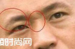 男人山根有横纹 男人桃花眼|眉毛弯的男人 眼中有痣的男人