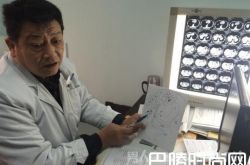 医生为患者绘图说病 41年绘了不下万张“医学图”