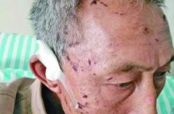 人猪大战！老汉深山血战野猪8小时负伤胜利