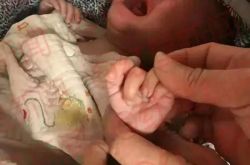 悲剧！男婴和姐姐被老鼠咬伤 奶奶正外出捡垃圾